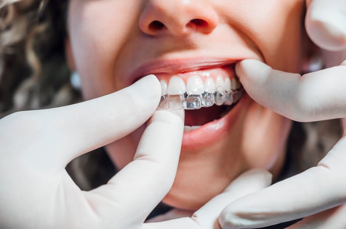 doctor-putting-clear-dental-aligner-patient-woman